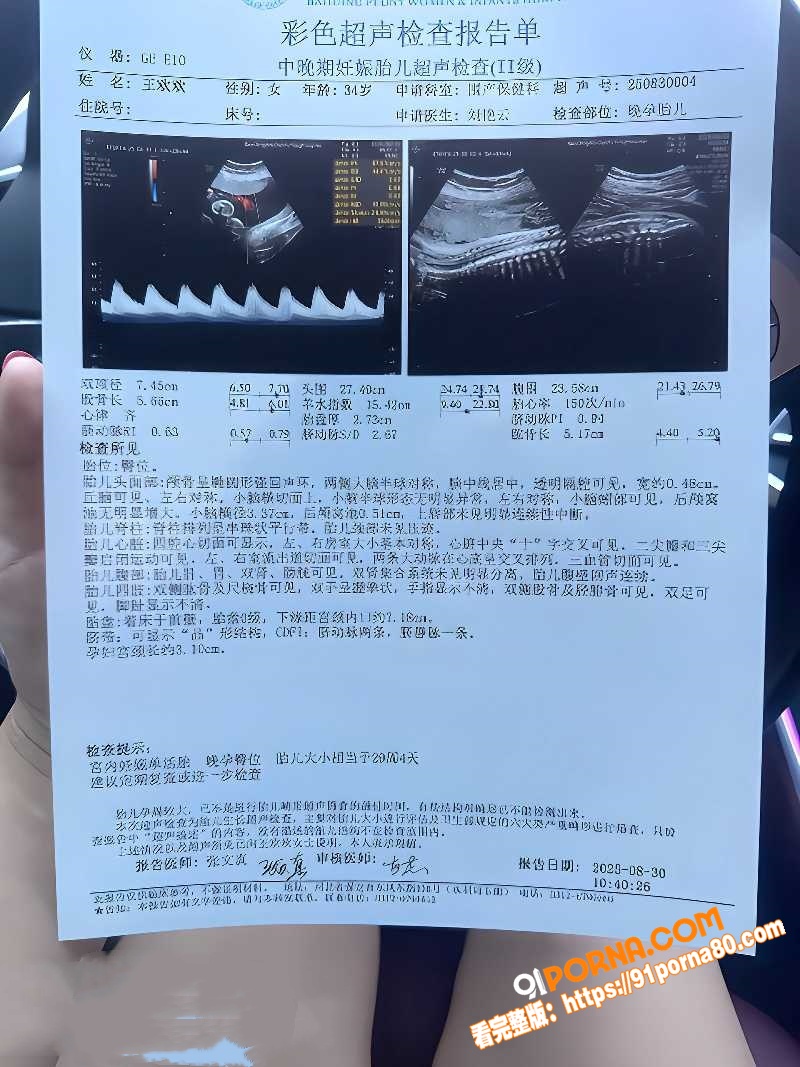河北顺平母狗 王欢 约炮...（4）